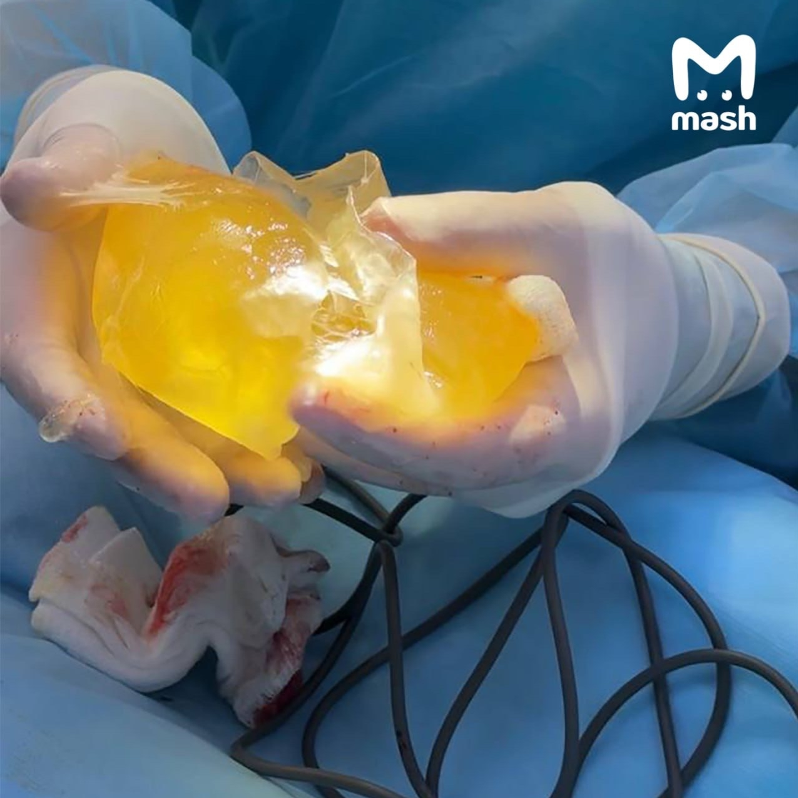 Шок! Өфөлә блогерканың имсәге шартлаған!