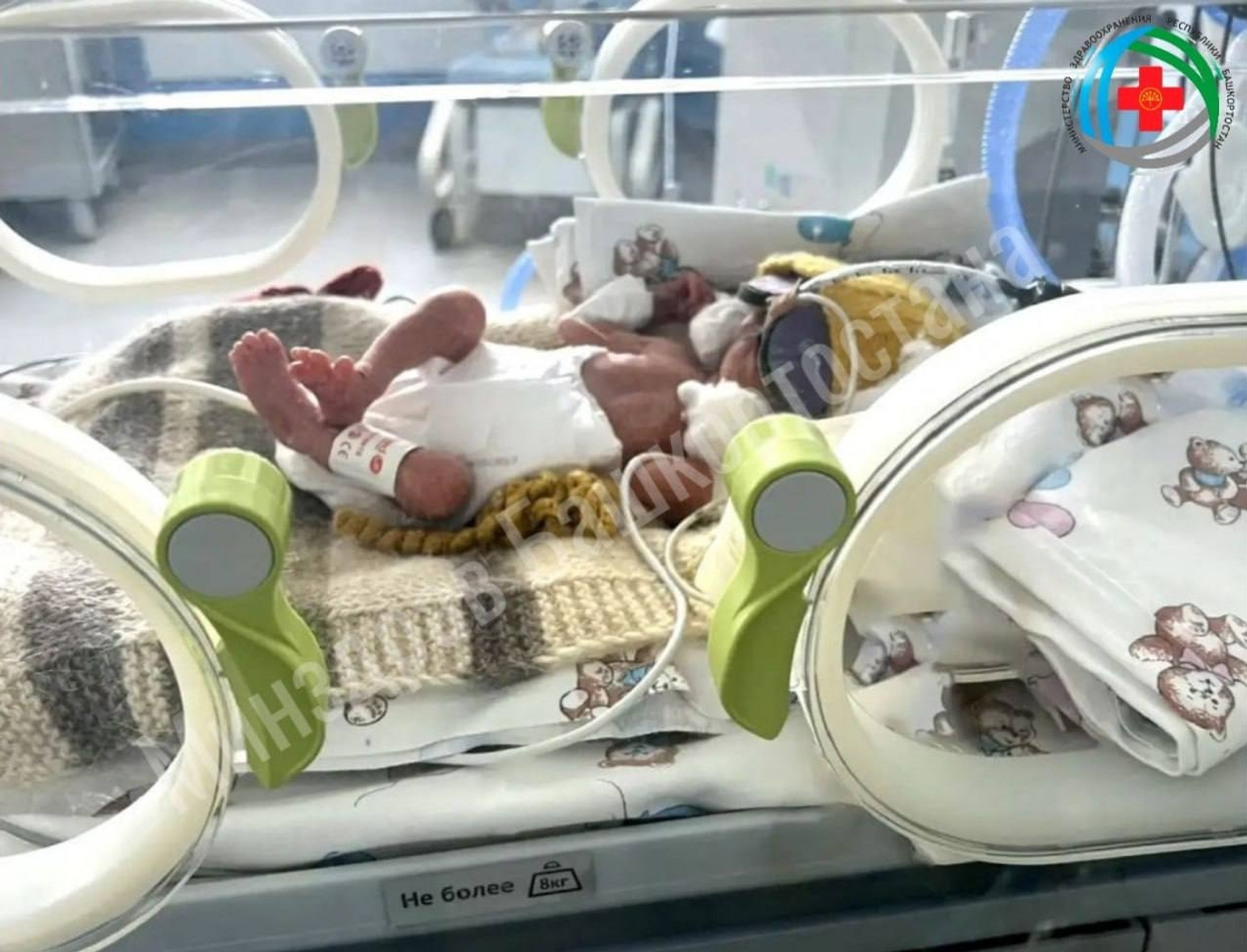 Башҡортостанда ғәҙәти булмаған сабый тыуған!