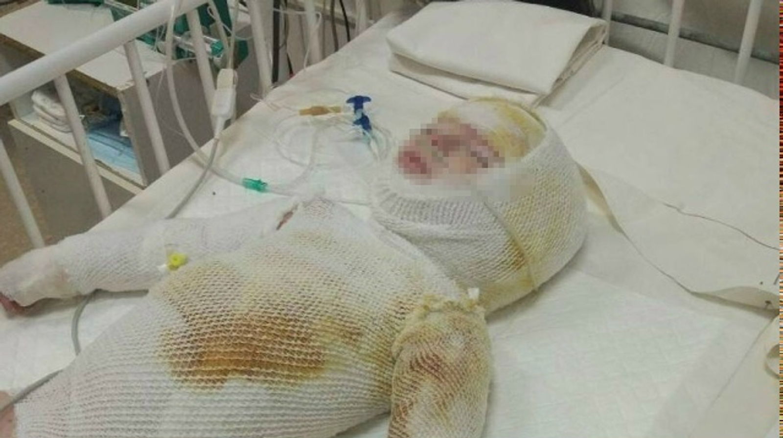 Йәш ярымлыҡ бала эҫе һыуға бешкән