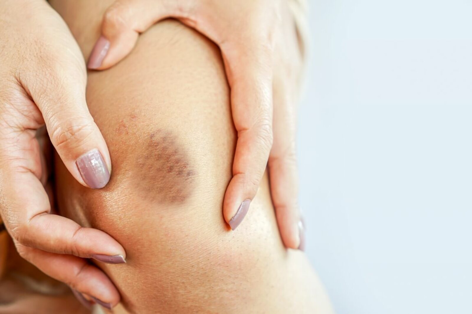 Тән күгәреүен бөтөрөү өсөн